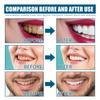 Mouthwash Remove Tooth Stains Odor Clean Yellow Tartar Whitening Teeth Lasting Fresh Breath Mouth Toothpaste Oral Smell Care