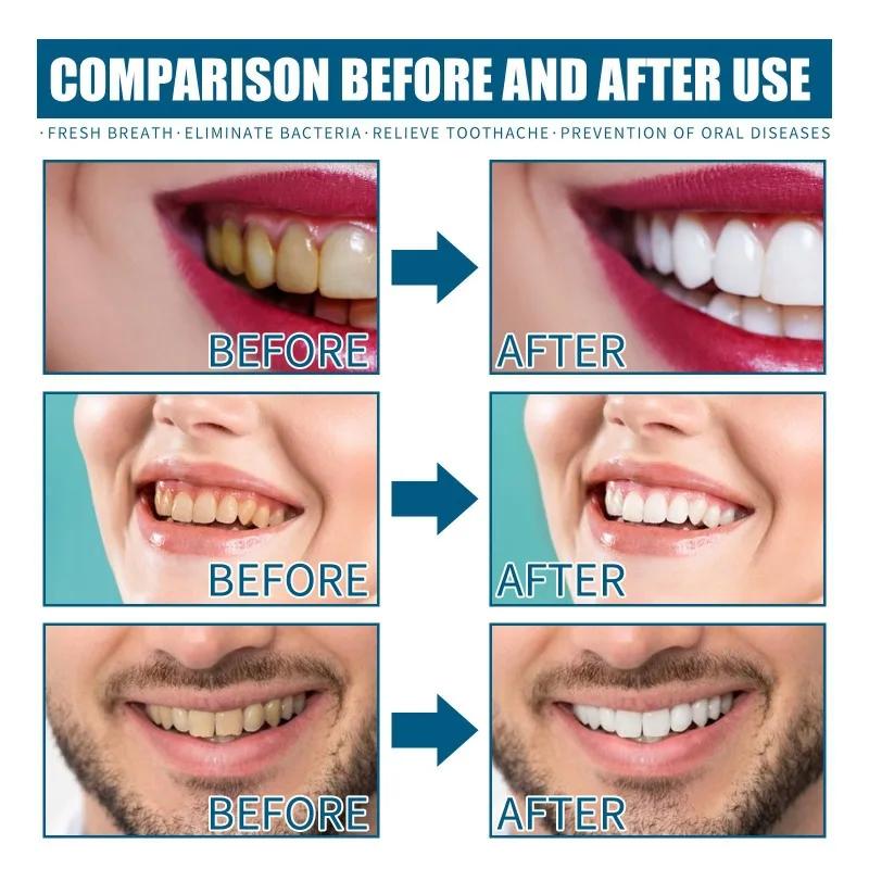 Mouthwash Remove Tooth Stains Odor Clean Yellow Tartar Whitening Teeth Lasting Fresh Breath Mouth Toothpaste Oral Smell Care