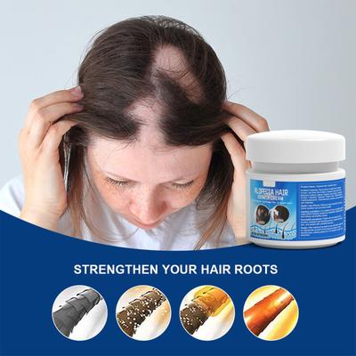 Crema Alopecia Areata Alivia la Caída del Cabello Activa los Folículos Paliativos Promueve el Crecimiento