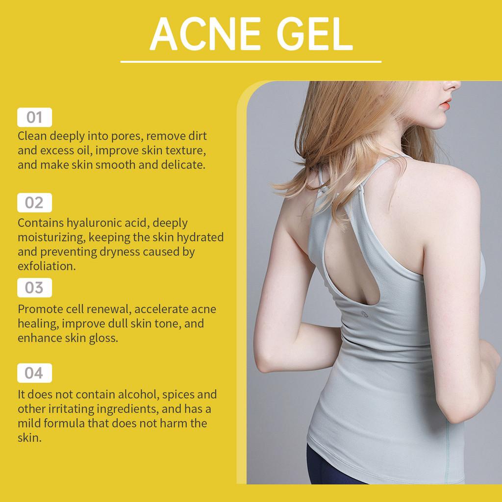 Eelhoe Soothing Acne Gel For Back Acne Gentle Skin Care Hydrating Formula 60ml