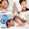 Anti-snoring Mouthpiece, Sleep Aid, Night Guard Protects Both Upper and Lower Teeth. Mouthpiece, Adjustable Size, Moldable, Prevents Noise During Slee