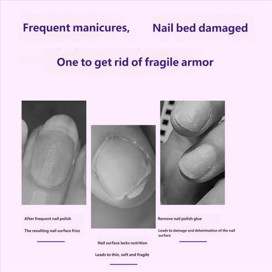 3.5ML 3-in-1 Nail Care Pen Cuticle Pusher Nail Oil Pen with Ceramic Tip Men Women Hangnail Dry Damaged Nails Cuticle Treatment Remover Pen