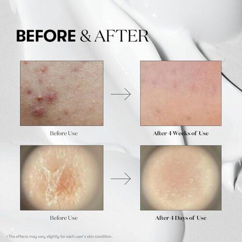 VT COSMETICS Reedle Shot 50