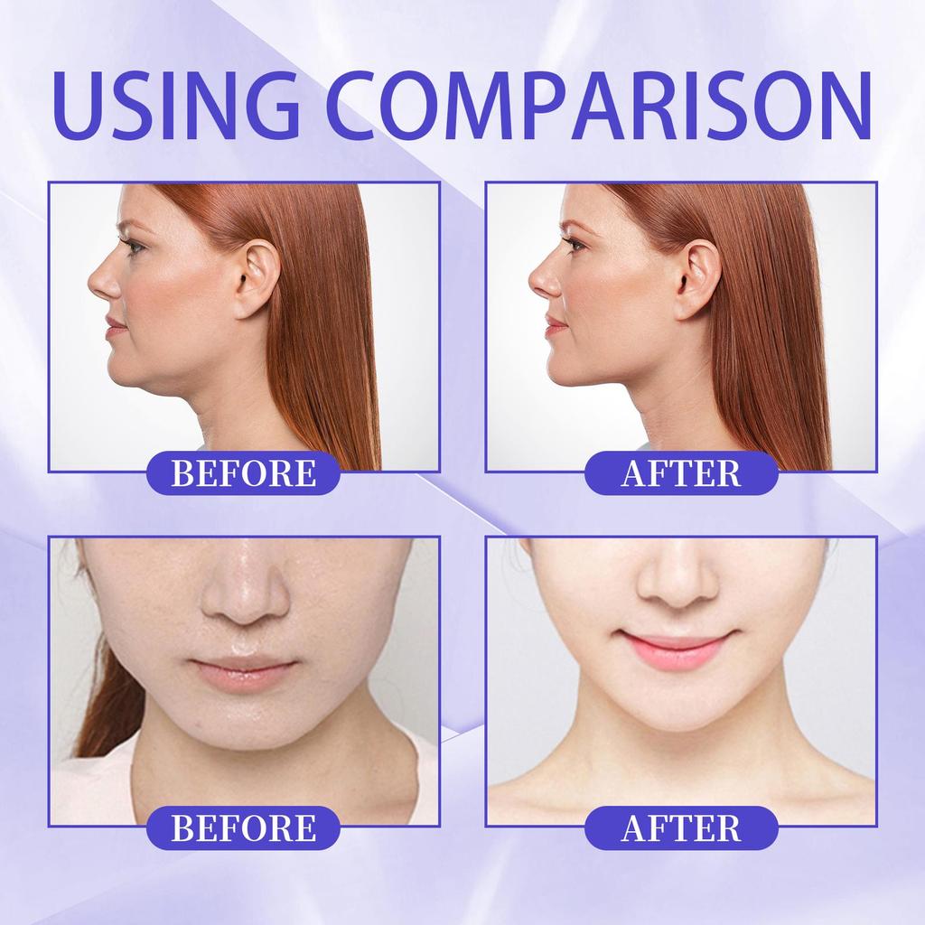 60 Stück Facelifting-Patch Hautstraffung Kinnverschlankung Muskellifting Schwellungsreduzierung Formender Patch