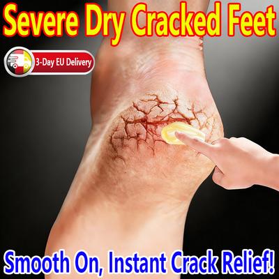 Foot & Hand Cracked Skin Cream - For Dry, Cracked Feet & Hands