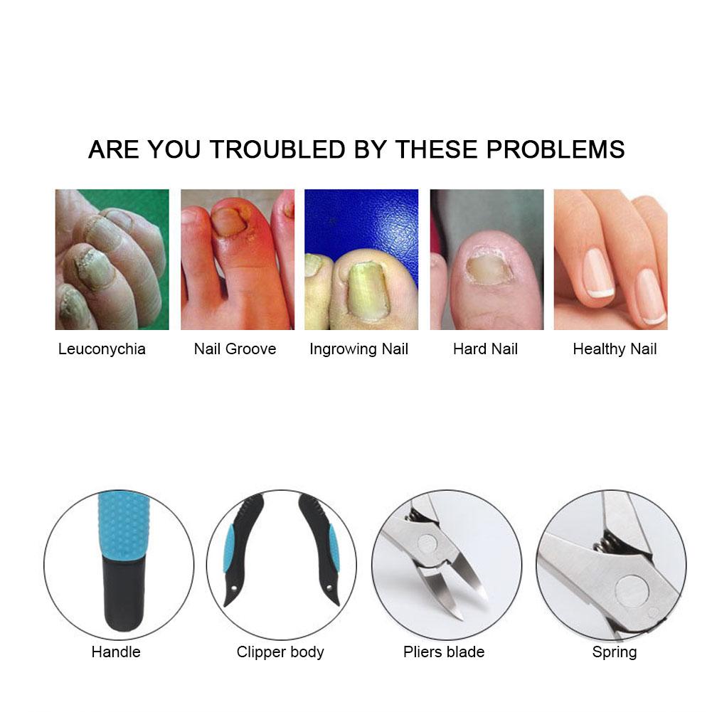 Ingrown Toe Nail Clippers Fingernail Toenail Cuticle Scissors Pedicure Cutter Tool