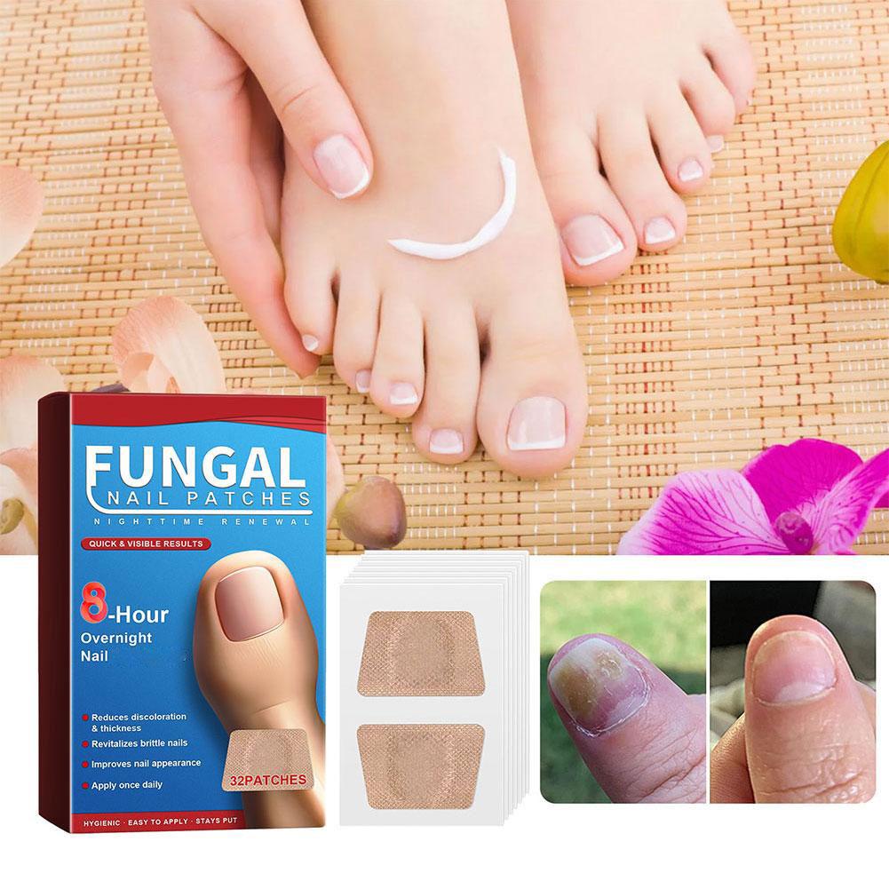 32 graue Nagelpilzpflaster zur Behandlung von Nagelpilzinfektionen, Handnagelreparaturaufkleber für eingewachsene Zehennägel