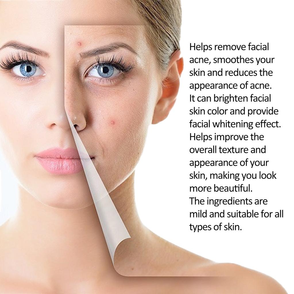 Eelhoe Tea Tree Anti-acne Essence Reduces Acne Pimples Fine Lines Clears Skin Tightens Pores And Moisturizes Skin Essence