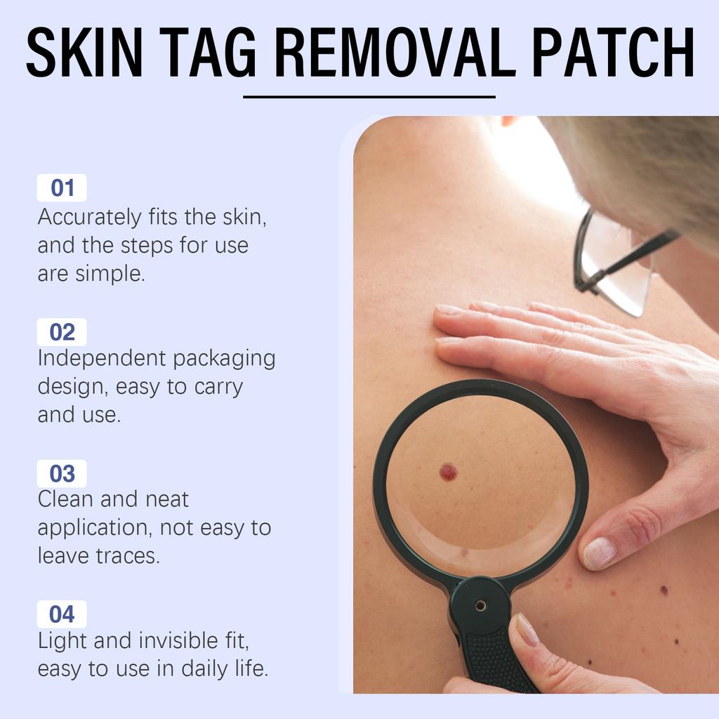 The Skin Nevus Care Patch Helps Improve Skin Feel. The Skin Care Patch Is A Gentle And Skin-friendly Care Patch.