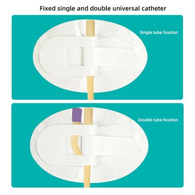 Cathéter de drainage sus-pubien, cathéter urinaire de jambe, tube double, cathéter à bande fixe, supports de bande urinaire de jambe, tube de support de cathéter