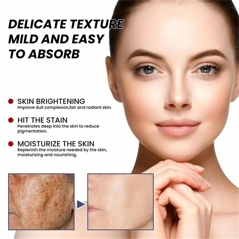 Freckle Remove Cream Whiten Face Cream Firming Moisturizing Anti-wrinkle Spot-removing Facial Cream Beauty Skin Care Serum