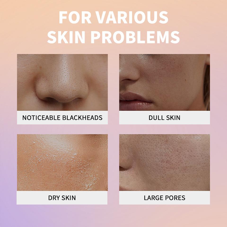 Rice Peeling Ampoule Soft Exfoliating Face and Body Scrub Dead Skin Cells Blackhead Remover for All Skin Types  Korean Skin Care