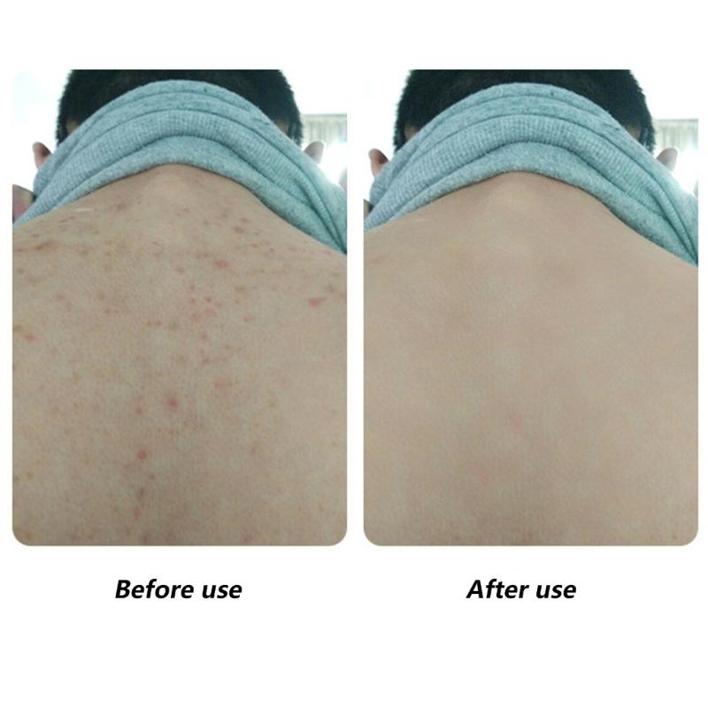 Langer Körper-Peeling-Schrubber Nylonnetz Bade-Schwämme Für Tiefenreinigung Und Massage Mehrfarbig