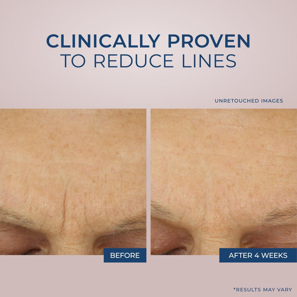 Rock Retinol Correxion Max Daily Hydration Cream 48g/1.7oz