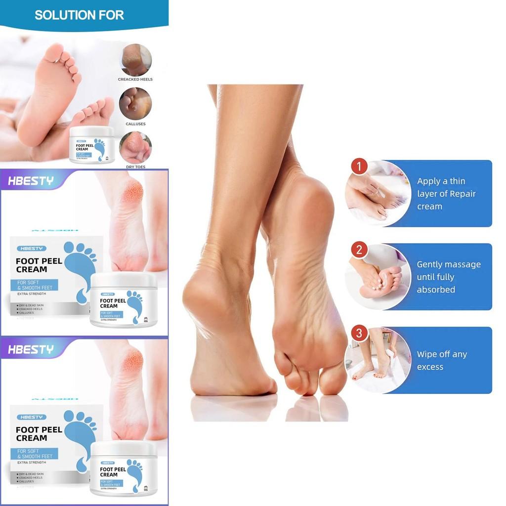 Hbesty Luxurious Foot Care Cream For Dry Cracked Heels And Calluses With Herbal Scent
