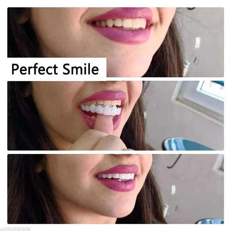 Silicone Denture Set Temporary Fake Teeth Orthodontic Braces Oral Care Whitening Simulation Dentures for Hygiene