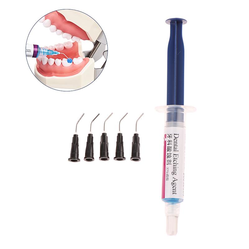 Dentalmaterial Ätzmittel 37% Phosphorsäure Ätzmittel Ätzgel Mit 5 Spitzen Für Kieferorthopädischen Klebstoff Lichthärtender Bond Zähne Kleber