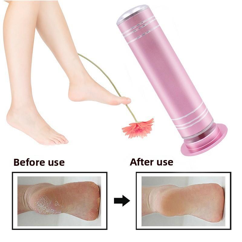 Electric Foot Pedicure Rasp Sander For Callus Dead Skin Treatment Gift Tool