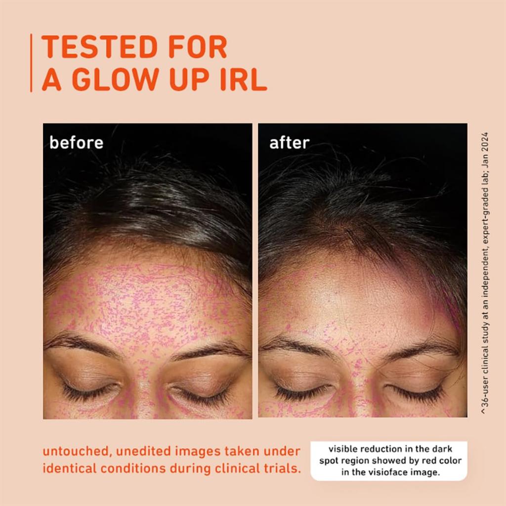 Plum 15% Vitamin C Serum for Glowing Skin | Face Serum for Oily, Dry & Combination Skin | 30ml