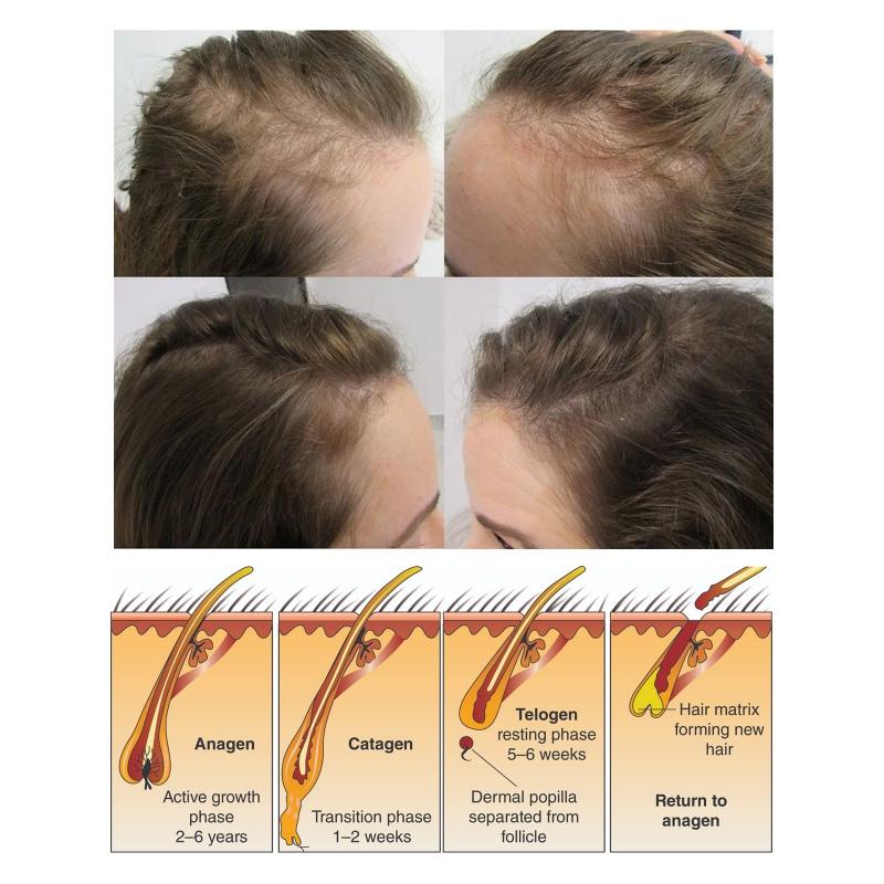 Shampoing au riz, traitement de la croissance des cheveux, contrôle de l'huile, barre de shampoing nourrissante, Anti-perte de cheveux, 100g