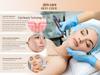 Dr. Pen A10 Electric Microneedle Derma Pen - Home Beauty Device for Skin Rejuvenation