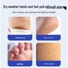 ADULTDINGDING Cracked Heel Repair Gel