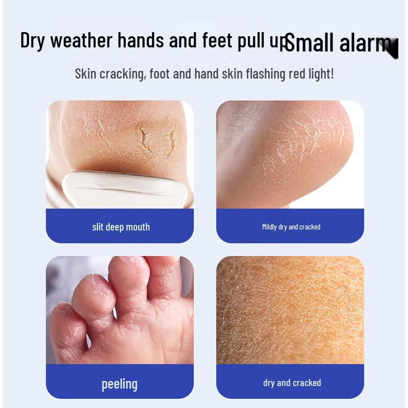 ADULTDINGDING Cracked Heel Repair Gel