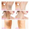 EELHOE Body Whitening Cream Underarm Knee Buttocks Private Bleach Remove Melanin Pigmentation Improve Dull Nourish Brighten Skin Care