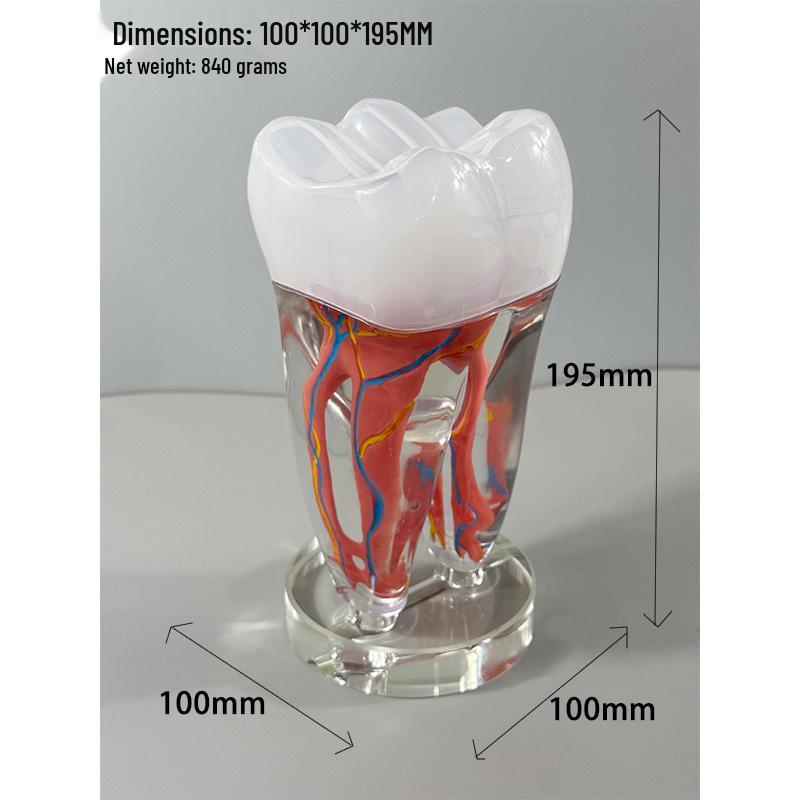 Прозора Знімна Повна Модель Щелепи з М'якими Яснами та Зубами для Підготовки до Імплантації