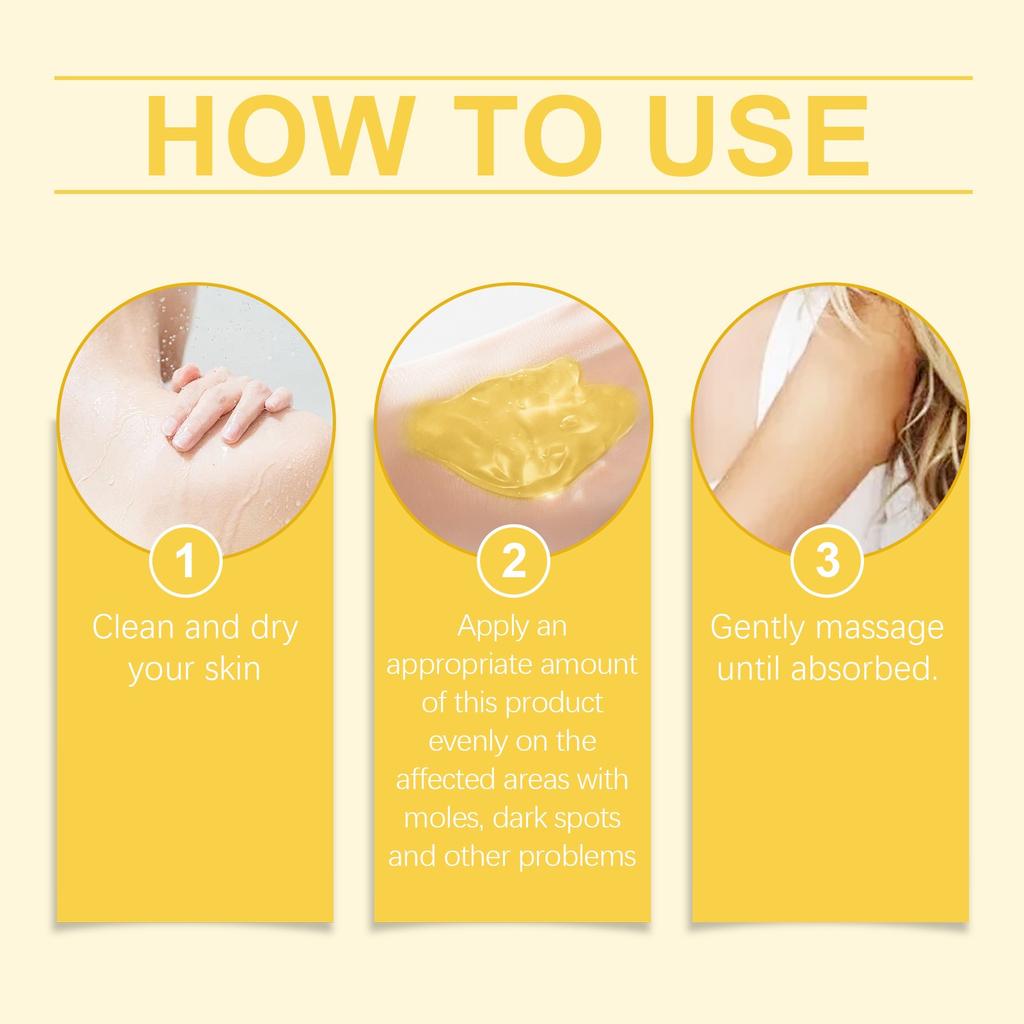 Freckle Removing Nevus Gel Whitening And Rejuvenating Skin Lightening Sun Freckle Brightening Skin Cream