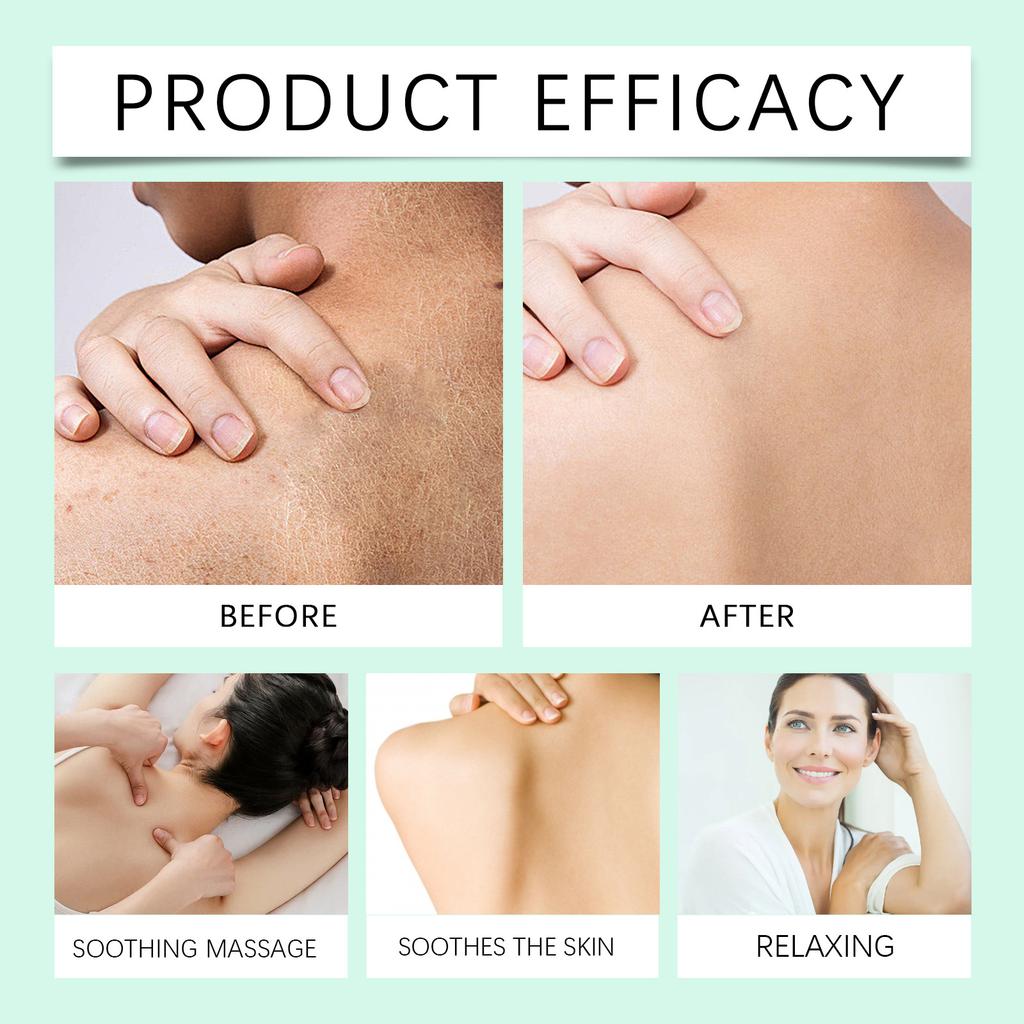 Herbal Soothing Massage Cream For Cervical Vertebrae And Shoulder Discomfort, Fever And Ointment For Shoulders, Neck, Waist And Back.