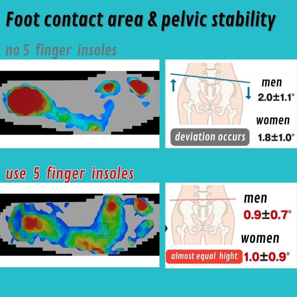 Innersula Smärta i fotsulorna på den flytande platta plantar fasciit Använd tårna för att minska trötthet Unisex M 5-tåfötter, hallux valgus, tår, fötter,