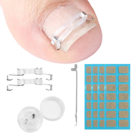Ingrown Toenail Corrector Kit for Curved Nail Stainless Steel Armor Buckle Toe Nail Straightener Ingrown Nail Tool