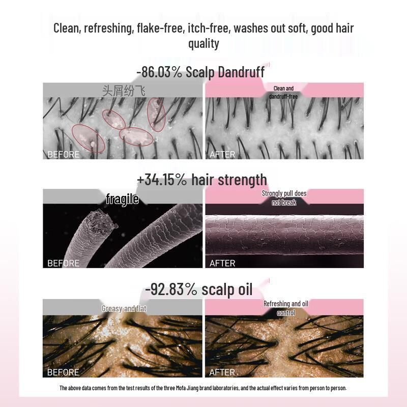 Three Magic Hairdresser Selenium Sulfide Anti-Dandruff Shampoo