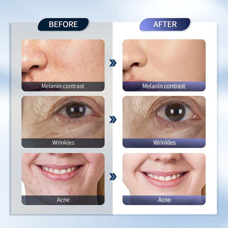 7 Color Photon Light Therapy Device, Facial Skin Rejuvenation Device for Home Use, Portable LED Light Therapy Machine for Anti-Aging and Skin Care