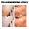 Facial Mask Deep Cleansing -aging Moisturizing Skin