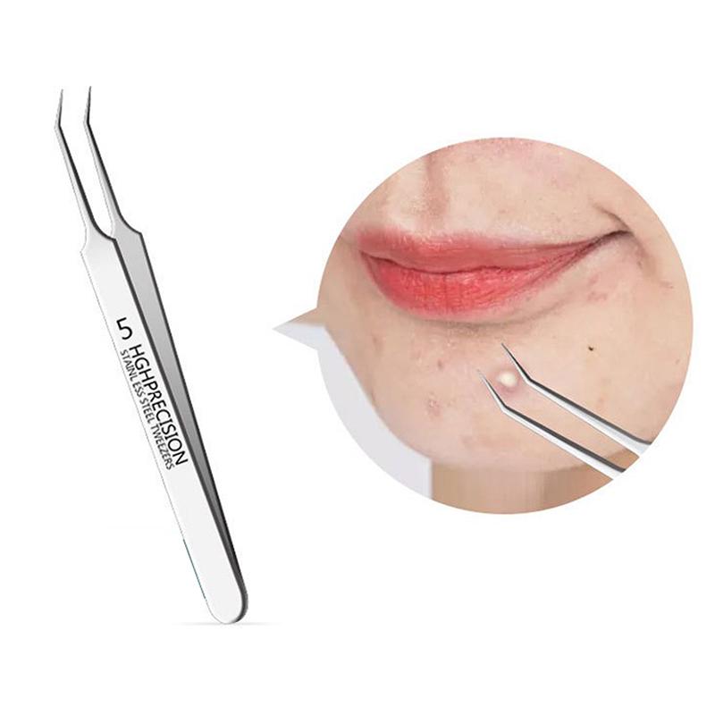 Blackhead Remover Tweezers Stainless Steel Pimple Remover Tweezers Precision Pimple Popper Tool Cell Clip For Skin Purification