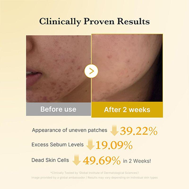 Medicube Kojic Acid Turmeric Pad (70ea)