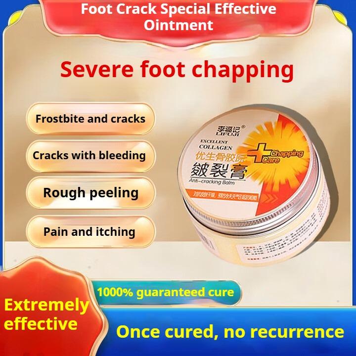 Cracked Feet Cream, Cracked Heels, Cracked Cracks, Fungal Infections, Special Cream for Frostbite Cracks In Hands and Feet