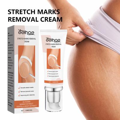Scar Removal Cream Gel Remove Acne Spots Treatment Stretch Marks Burn Surgical Scar Repair Cream Smoothing Whitening Skin Beauty 45g