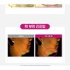 CKD Guaranteed - Retino Collagen Small Molecule 300 Guasha Neck Cream