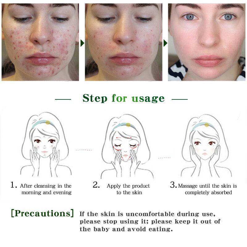 Oligopeptide Acne Clearing Serum Treatment Cream Pore Repair Anti Aging Moisturizing Essence