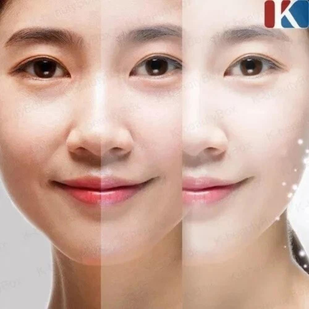 3Pcs Kojic Acid Serum - Collagen Face Serum for Skin Lig_htening - Anti Aging Face Serum - Dark Spot Correcting Glow Serum 30ml