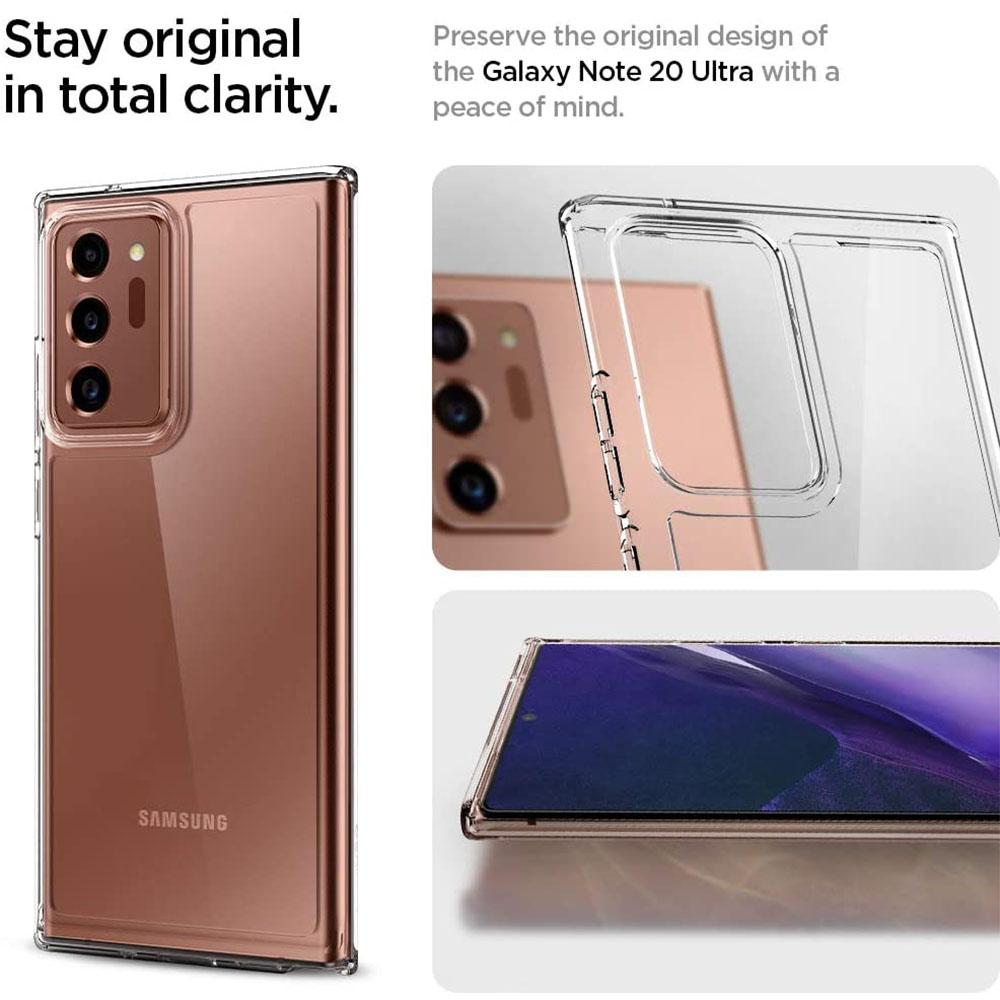 Süße Niedliche Haustier Hamster Handyhülle Für Samsung A55 A35 A25 A15 A54 A34 A24 A14 A70 A71 A50 A51 A17 A05S Galaxy A40 A41A30 A31 A2