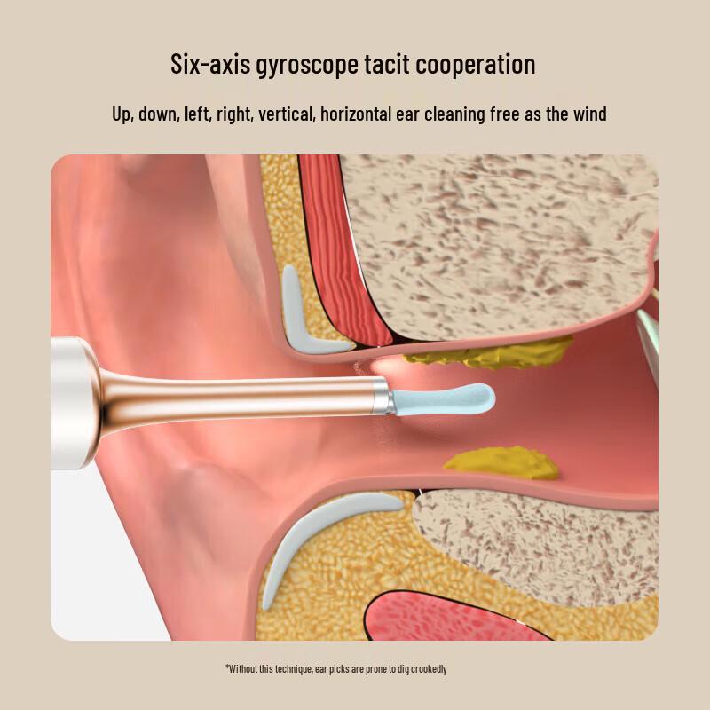 Bebird Smart Visual Ear Pick and Pimple Extractor