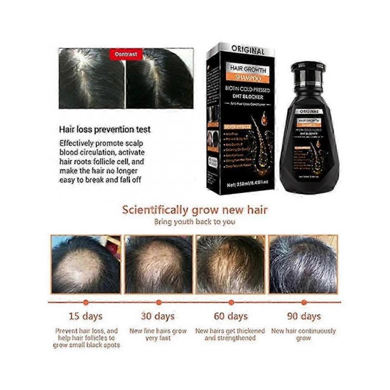 Ginger Shampoo Hair Treatments Hair Growth Hair Care Anti-hair Loss Hair