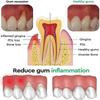 Gel Cura Riparazione Gengive Allevia Gengive Doloranti Migliora Infiammazione Gengivale Danneggiata Pulizia Macchie sui Denti Tartaro Sbiancante Gel Protettivo Gengive