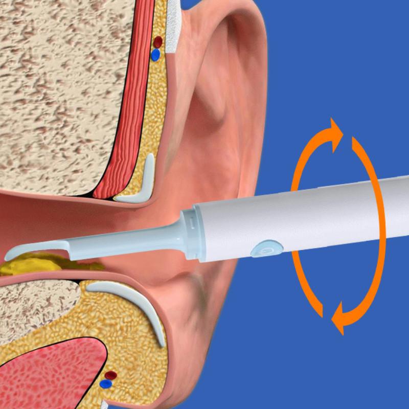 High Definition Intelligent Visual Earpick WiFi Connection Endoscope Flashlight Ear Cleaning Tool Set