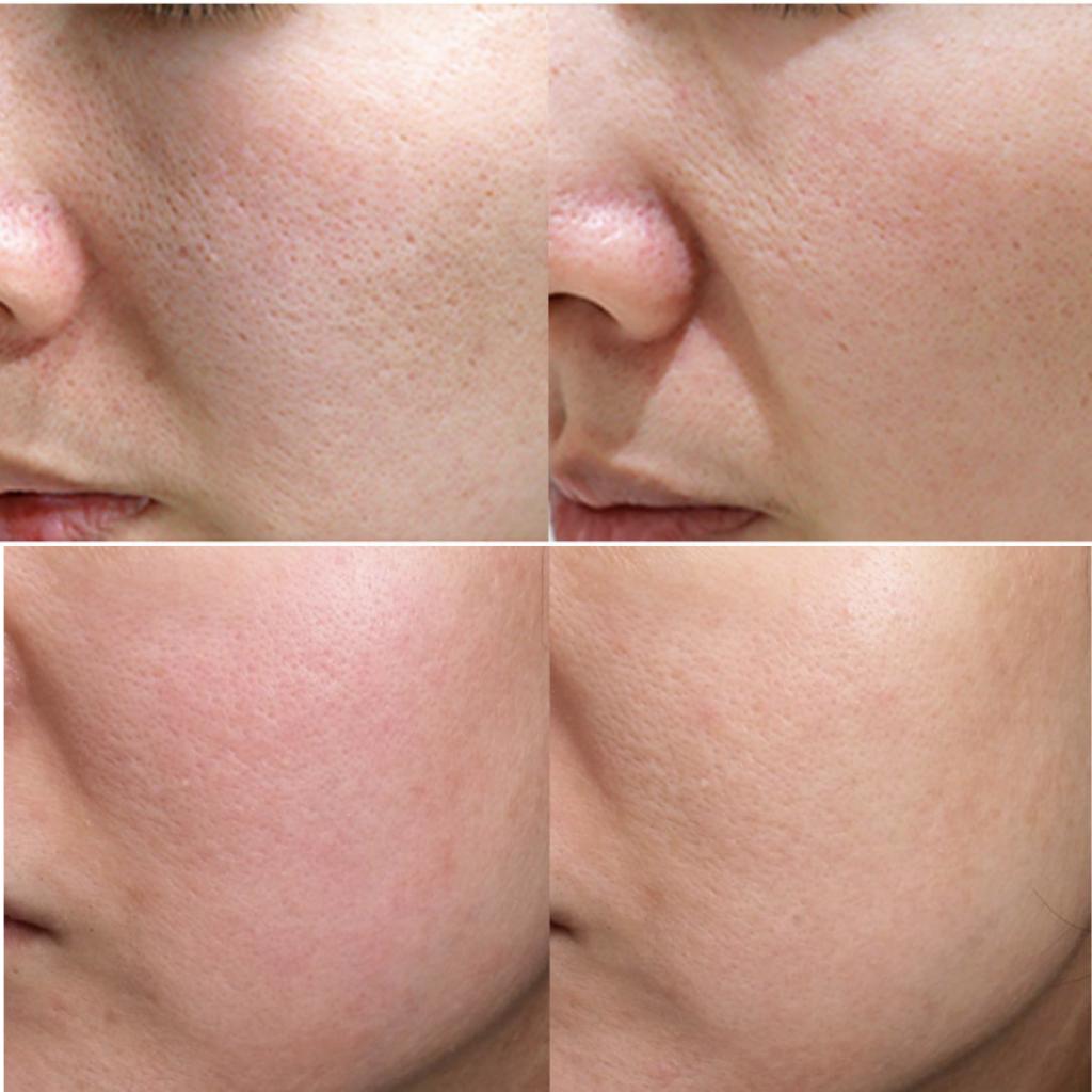 [VACIAN] PDRN Exosome Dual Shot 700 Ampule 30ml