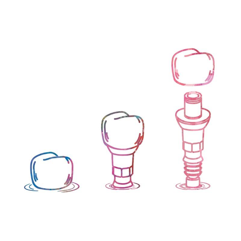 Watercolor Teeth Implant Canvas Painting Tooth Fairy Dental Art Poster Dentist Anatomy Print Wall Pictures Hospital Clinic Decor